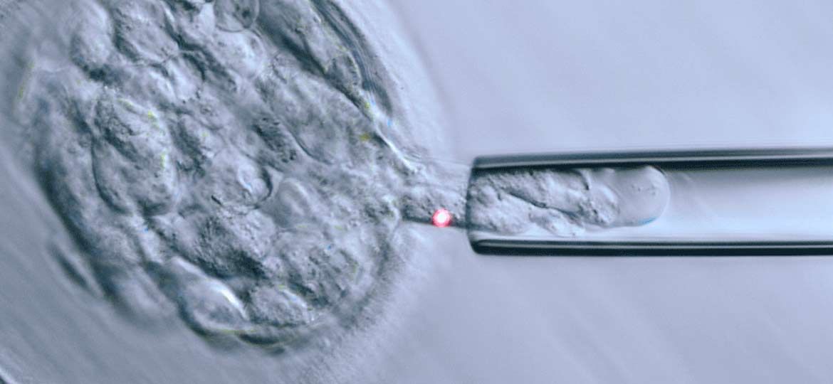 diagnostico genetico preimplantacional