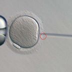 fecundacion in vitro