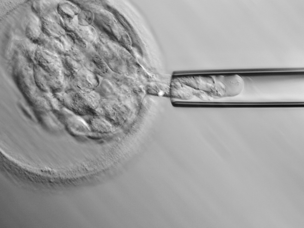 DGP-biopsia blastocisto (1) edit