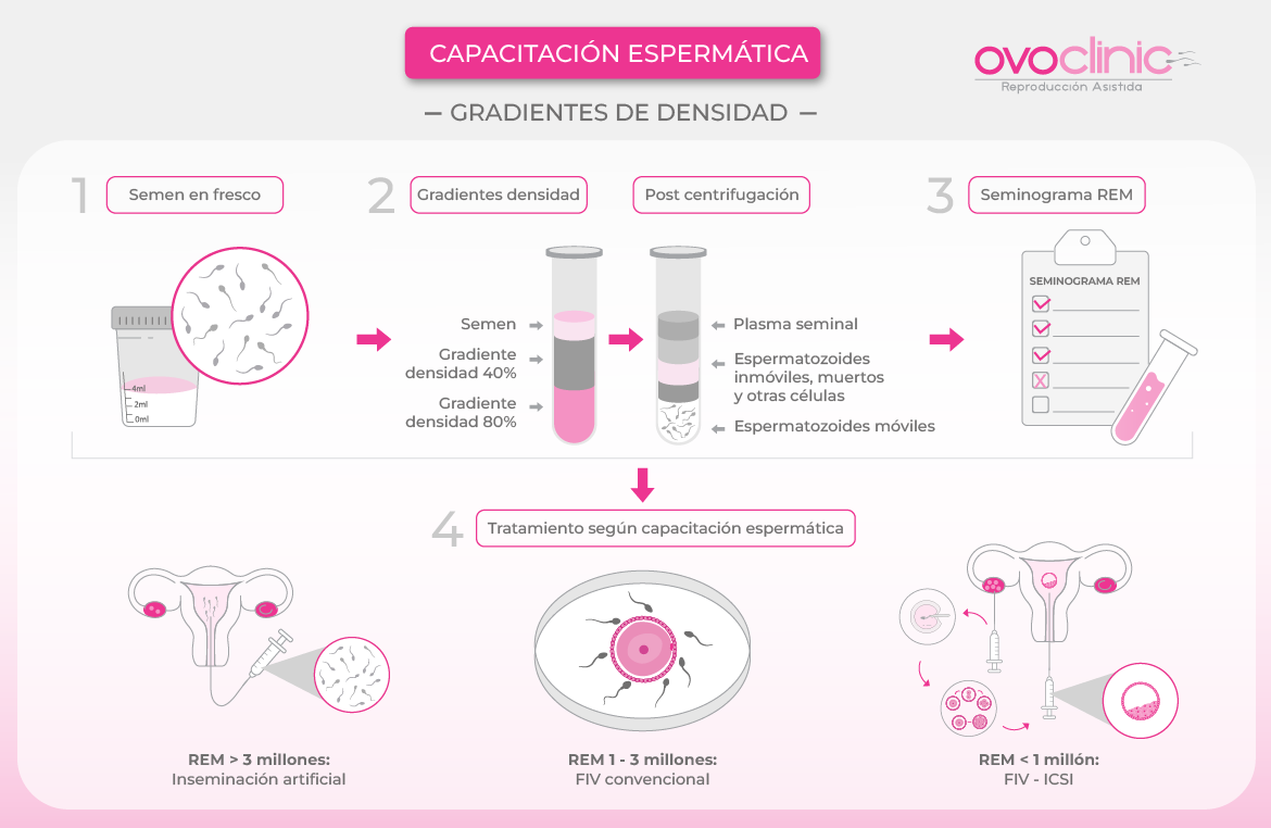 Ovoclinic utiliza los gradientes de densidad Los pasos de la capacitación espermática