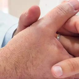 Este es el impacto del cáncer en la fertilidad de los más jóvenes
