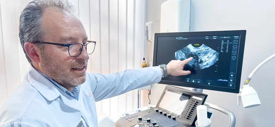 Hiperplasia endometrial - Doctor Sosa
