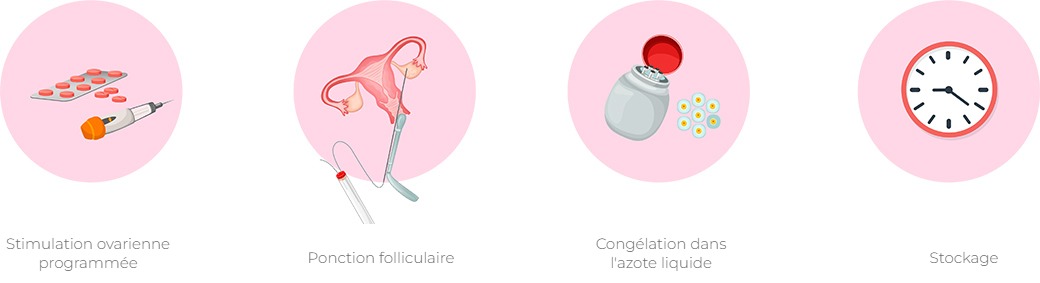 Étapes de la congélation des ovules : stimulation ovarienne programmée, ponction folliculaire, congélation dans l'azote liquide et stockage